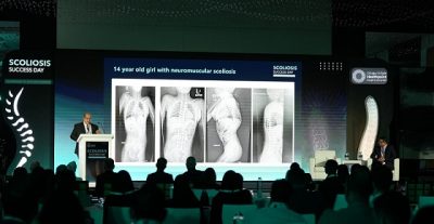 أكثر من 70 حالة شفاء تضيء فعالية “يوم نجاح علاج الجنف” في أبوظبي